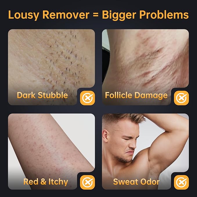 CKM Hair Removal Cream for Men, Depilatory Cream for Unwanted Male Hair, Painless Hair Removal Gel Suitable for All Skin Types, Made for Men, 6.76 FL OZ w/Spatula