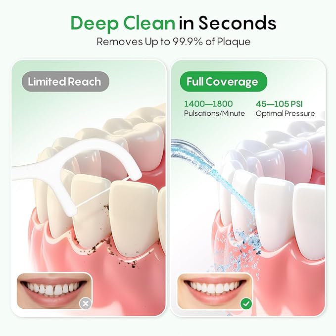 FRESKO Water Dental Flosser for Teeth, 300ML Flosser with Constant Pressure, Rechargeable Oral Irrigator Cleaner for Travel with 5 Jet Tips, IPX7 Waterproof