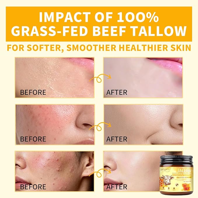 Beef Tallow for Skin, 100% Organic Grass-Fed Beef Tallow & Raw Honey Balm - Deep Nourishing Moisturizer for Face and Body, Sensitive Skin - All Natural Formula - 4.2 OZ