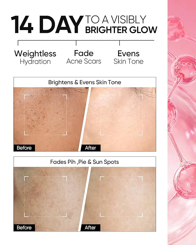 MSH Niacinamide Brightening Cream,Fades Dark Spots, Evens Skin Tone, Tranexamic Acid, α-Arbutin, 5X Ceramides, Centella Asiatica, Suitable for Oil and Acne-prone skin, 3.52fl.oz / 100g