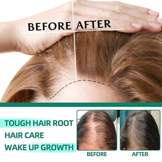 Anti-Hair Loss and Hair Growth Solution, Anti Loss Hair Conditioner, Herbal Hair Care Serum (3 Pcs Set)