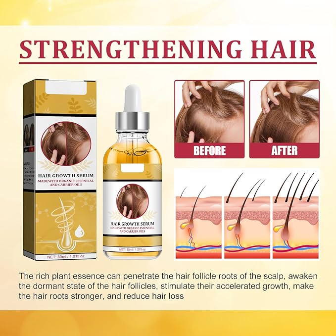 30ml Hair Growth Serum for Women & Men – Natural Plant-Based Formula with Ginseng & Ginger Oil to Reduce Hair Loss, Thicken Hair, and Stimulate New Growth