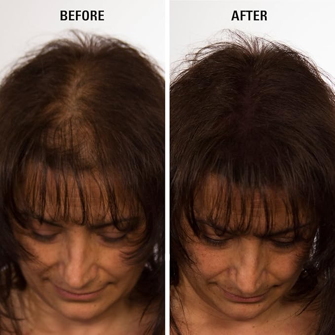 ECLIPSE Hair Fibers Auburn for Thinning Hair for Women & Men to Conceal Hair Loss in 15 Seconds - 100% Undetectable Hair Building Fibers, 30g