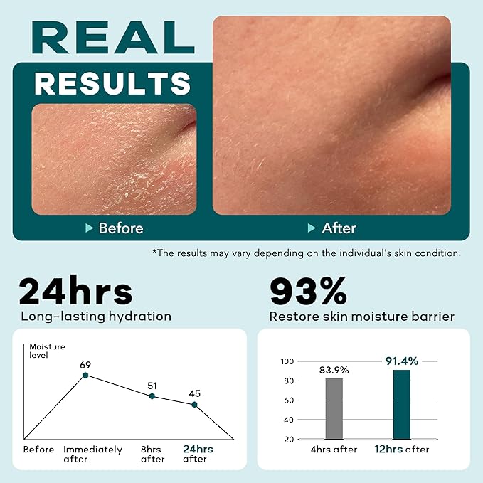 6-in-1 Face Cream for Men: Hydrating Water Based Men Face Moisturizer with Retinol, Collagen, Sodium Hyaluronate - Mens Anti Aging Face Cream for Day and Night Use