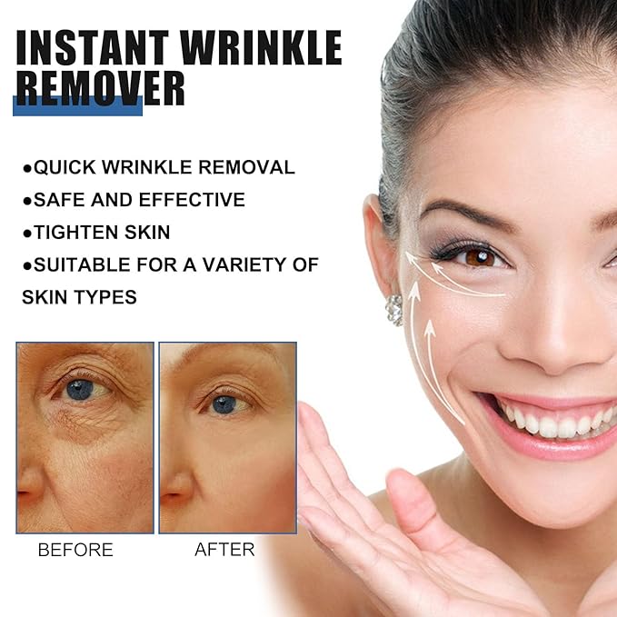 2PCS Retinol Anti-Aging Face Cream, 5 Seconds Instant Anti Wrinkle Face Cream for Tightening and Firming Retinol Face Moisturizer Reduces Wrinkles, Fine Lines for Women and Men