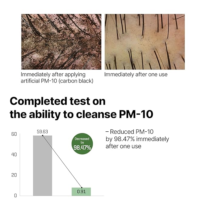 Some By Mi - Cica Peptide Anti Hair Loss Derma Scalp Tonic 150mL