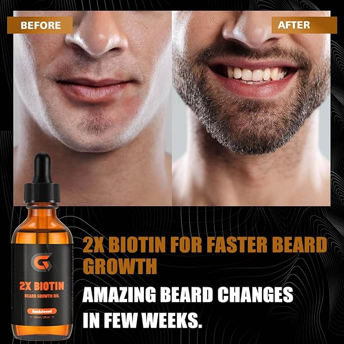 2X Biotin Beard Growth Oil for Men - Natural Organic Leave-in Conditioner & Softener - Mustache & Facial Hair Thickener, Moisturizer & Strengthener - Anti Itch & Dandruff Serum, 2 fl.Oz (Sanda)