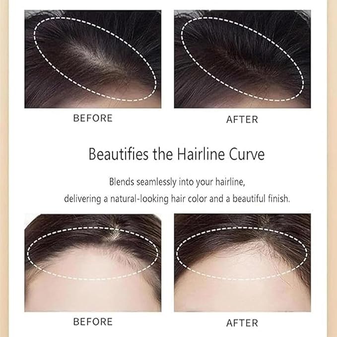 Hair Concealer, Sweat-proof Hair Filling Cream for Men and Women, Hairline Powder for Thinning Hair, Root Cover Up Spray for Instant Hair Shading (2Pcs)