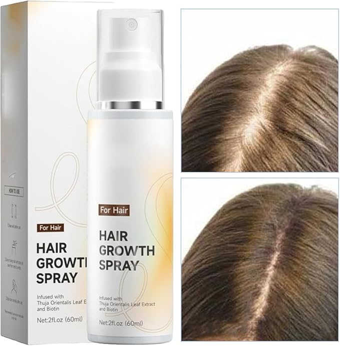 2026 Hair Growth Spray 60ml–Natural Rosemary Oil for Hair Growth,Non-Greasy Anti-Thinning&Hair Loss Prevention,Biotin&Cypress Extract,Lightweight Daily Scalp Spray,for Men&Women (3PCS)