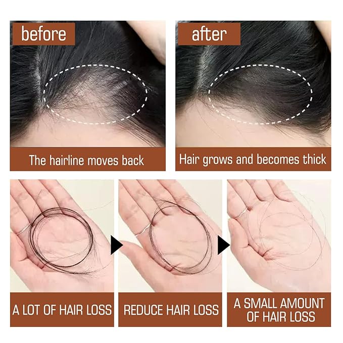 Batana Oil Hair Growth Cream Conditioner – Organic Natural Formula from Honduras for Thicker, Fuller Hair – Promotes Growth & Helps Prevent Hair Loss for Men & Women,3PCS