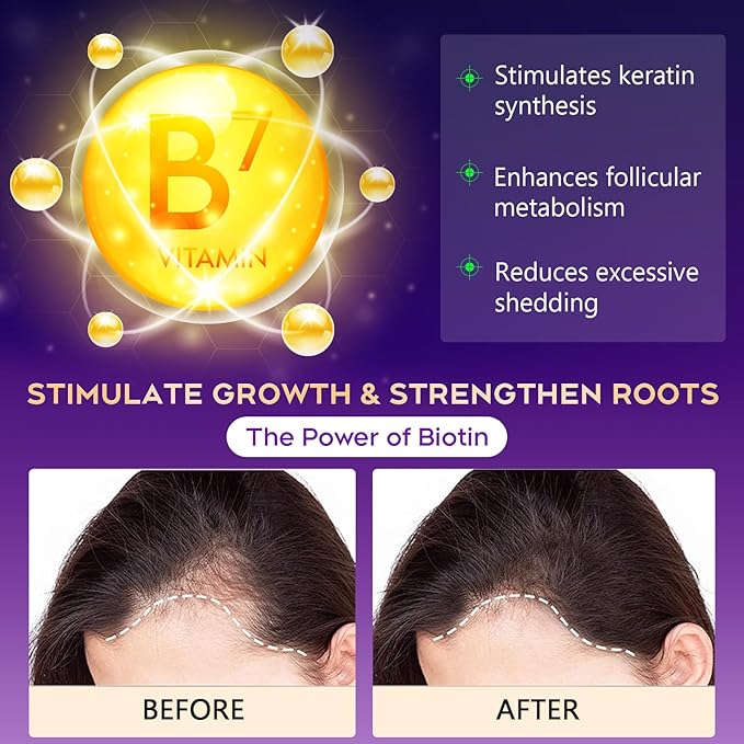 Biotin Hair Growth & Thickening Shampoo with Root Activator, Hair Loss Shampoo for Men And Women, Strengthen Roots, Control Oil & Thicken Thin Hair, Sulfate-Free, for All Hair Types, 10.1 Fl Oz-Fresh