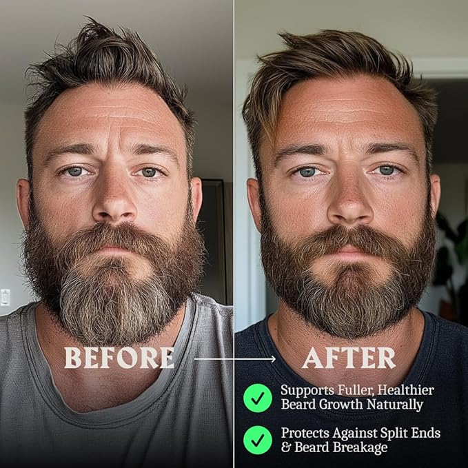 Striking Viking Beard Balm & Beard Oil for Men – Unscented, 1 Fl Oz Each - Dual-Use Leave In Conditioner - Tames, Styles & Moisturizes – With Naturally-Derived Argan & Jojoba Oil