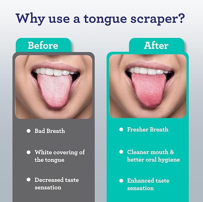 GuruNanda Tongue Scraper for Adults (6 Pack) with Travel Case, 420 Medical-Grade 100% Stainless Steel Tongue Cleaner, Aids in Fresh Breath & Oral Care