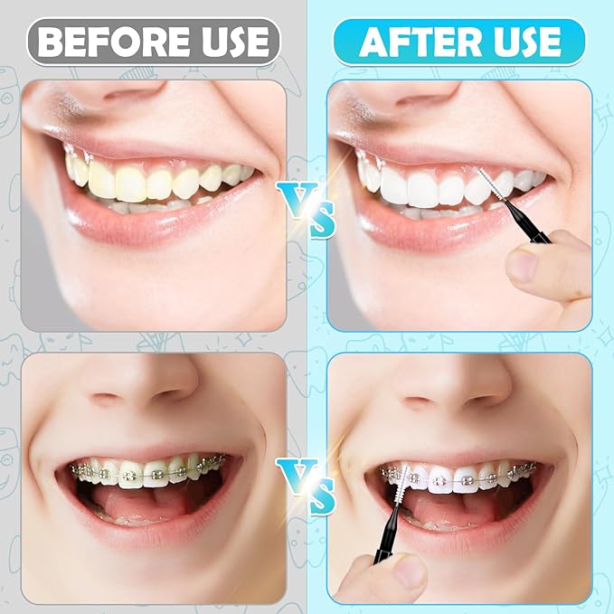120 Pieces Interdental Brushes, Braces Brush Cleaner Orthodontic Flossers Toothpicks Floss Picks for Braces Kit for Teeth Cleaning Tools Spiral Dental Brush Head for Efficient Oral Care Black