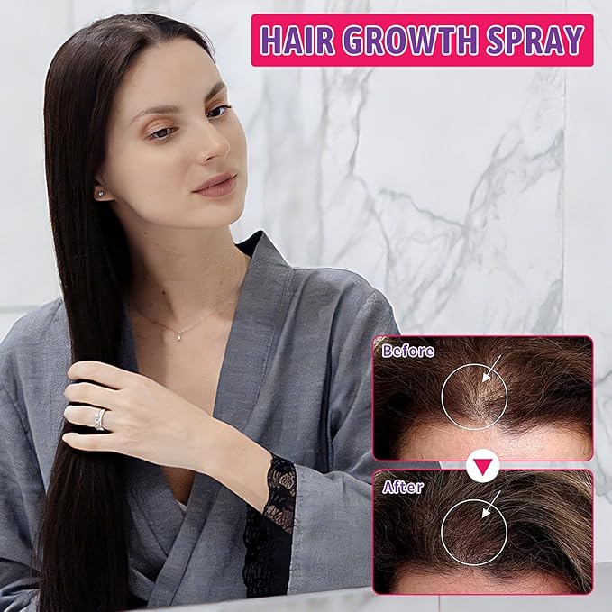 5% Minoxidil for Women Hair Growth with Biotin, Minoxidil Spray Helps Promote Thicker, Stronger & Fuller Hair, Supports Regrowth and Reduces Hair Thinning, Suitable for All Hair Types, 3.38 oz