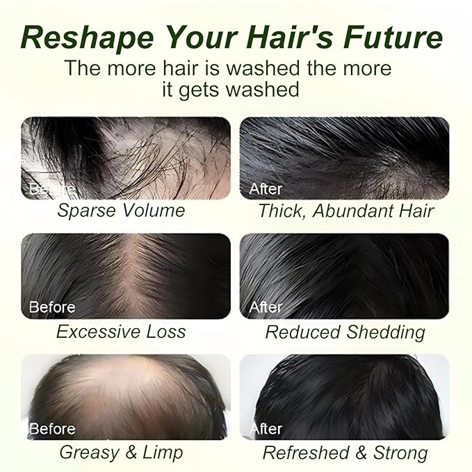 Tgideas Batana Oil & Rosemary Shampoo for Hair Growth, Formula for Thinning Hair & Reduce Hair Loss, Nourish Scalp & Add Volume, for Men & Women (Pack of 2)