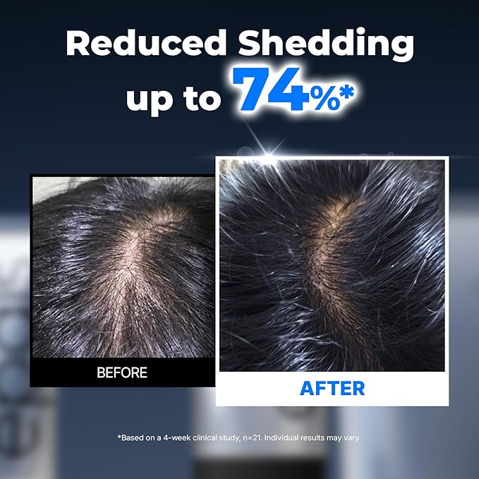 EPAIS Scalp Boosting Ampoule
