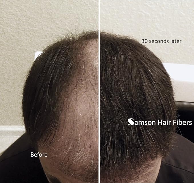 for Thinning Hair - 100% Undetectable Natural Formula - Completely Conceals Hair Loss in Seconds. Covers bald spots. Thicken your hair instantly - 25 Grams Refill (LIGHT BROWN)