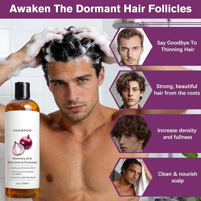 Rosemary Shampoo with Onion & Biotin,Shampoo,With Rosemary Oil, Red Onion, Cinnamon, Effectively Prevent Hair Loss,Support Hair Regrowth For Women Men