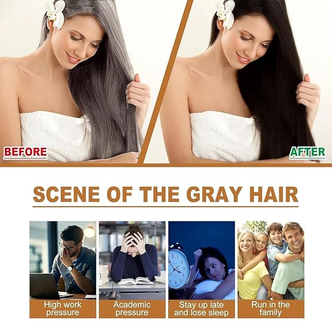 Saffron Essence Spray, Herbal Extracts Hair Serum,Lost Strengthen Hair Root, Non-Frizzy, Prevent Gray Hair (3 Pcs)