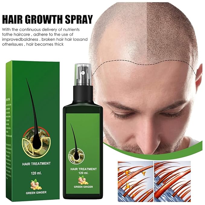 Ginger Hair Growth Serum with Ginger Oil - Anti Hair Loss Treatment, Promotes Thicker, Fuller and Faster Growing Hair (4 FL OZ) (1 Pcs)