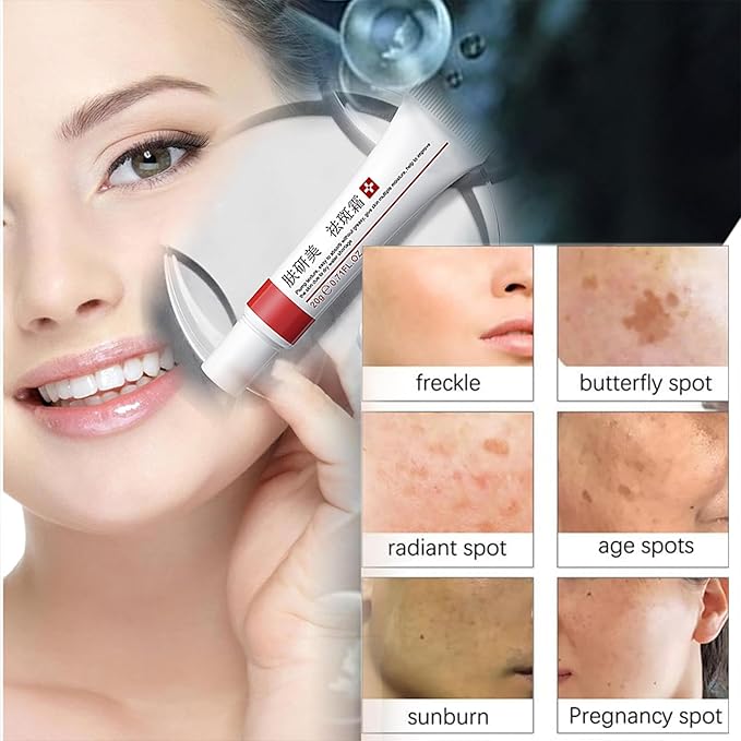 Generic Crema para Manchas Oscuras en La Cara, Dark Spot Remover for Face, Freckles Melasma Brown Spot Corrector for Men Women, Crema para Las Manchas de La Cara 20G