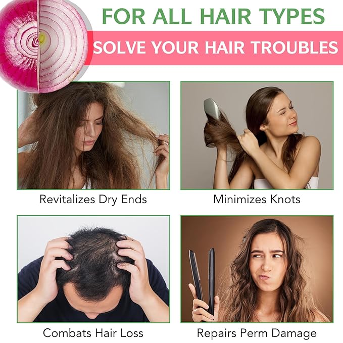 Onion Biotin Rosemary Conditioner – Natural Hair Growth Care for Dry Damaged Hair | Moisturizing Conditioner to Strengthen, Hydrate & Revive Frizz-Free Shine (8.45 fl.oz)