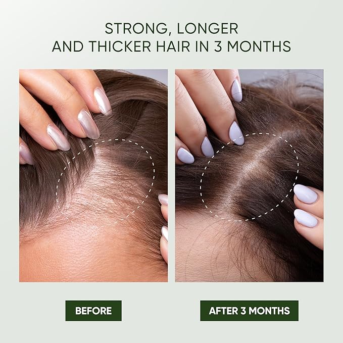 Svvimer Rosemary Hair Growth Shampoo - Thickening and Regrowth Formula for Men & Women - Strengthening Shampoo with Tea Tree Oil Biotin - For Thinning Hair and Hair Loss 11.8 fl.oz