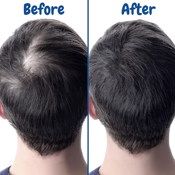 Verseo Sup Hair Growth Conditioner Treatment | Conditioner for Thinning Hair and Hair Loss | Repairing Damaged Hair | 28 Day Supply