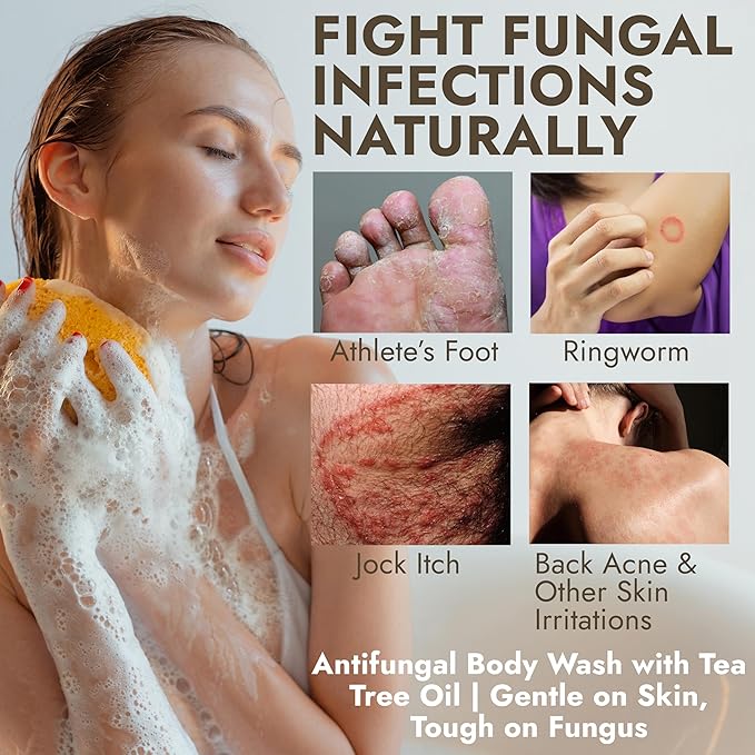 Antifungal Body Wash with Tea Tree Oil | Antibacterial Soap for Back Acne, Eczema & Jock Itch,Treats Ringworm | Antibacterial Body Soap For Men And Women (1% Tolnaftate Medicated Body Wash) 16.9 oz