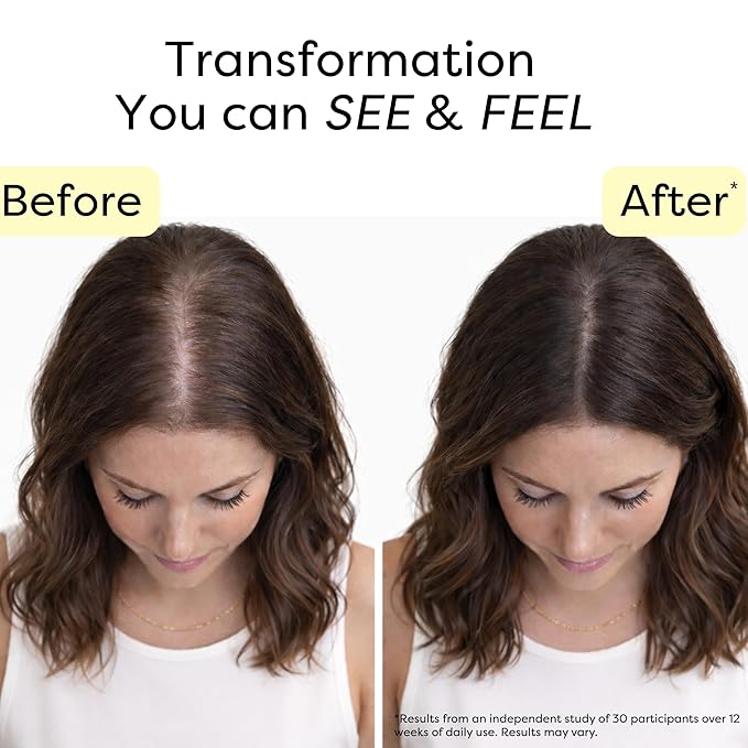 SuperGrowth Hair Growth Serum - Lightweight Water-Based Scalp Treatment Serum for Thicker, Fuller-Looking Hair | Caffeine, Peptides, Rosemary & Turmeric | Thinning Hair 2 fl oz