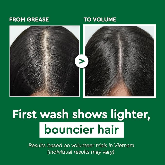 VIETNAM Shampoo and Conditioner Set for Thinning Hair, Lemongrass and Ginger Shampoo for Hair Strengthening & Reduced Breakage, Paraben Free (17.64 oz, 2 Pack) COCAY HOALA