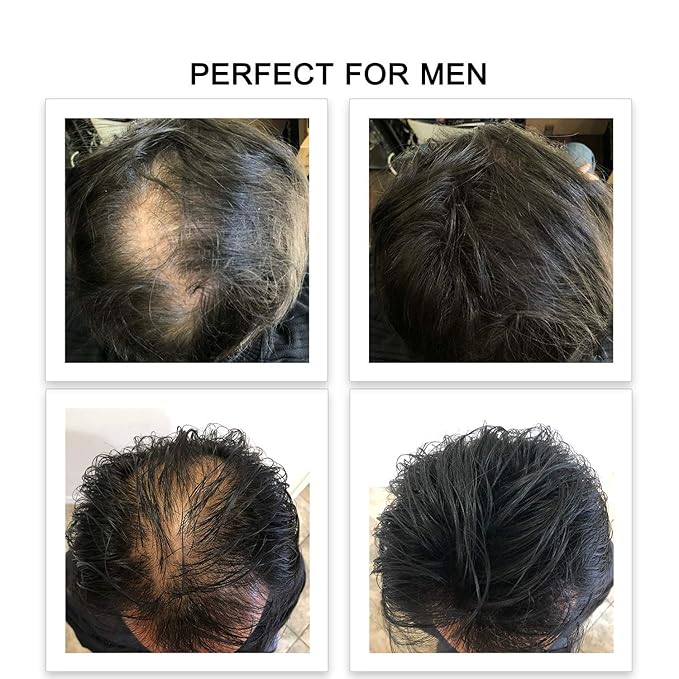 FEBRON Hair Fibers For Thinning Hair DARK BROWN For Women & Men Hair Loss Concealer Hair Powder Volumizing Based 100% Undetectable & Natural - Bald Spots Filler (30 Gram, Dark Brown)
