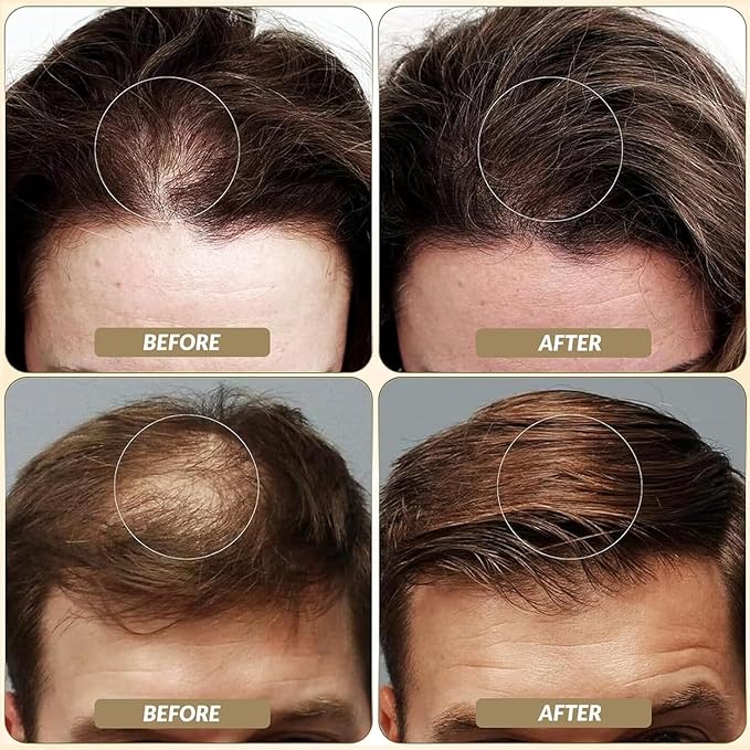 SOVONCARE Hair Fibers for Thinning Hair Medium Brown, Hair Building Fibers for Bald Spots Undetectable & Natural, Conceals Hair Loss Fill In Fine Hair Powder Hair Thicker Instantly for Women & Men 28g