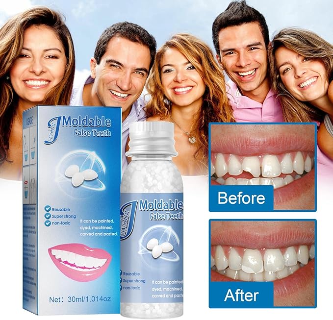 Dental Repair Denture Repair Beads,Tweezers,Dental Pick,Dental Tools for Fixing Filling Missing Broken Tooth Moldable Fake Teeth