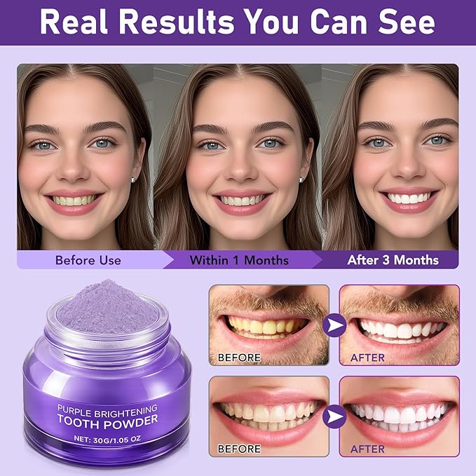 Teeth Whitening Powder - Enamel-Safe Brightening Powder for Stains - Helps Remove Coffee, Tea, Wine & Tobacco Stains - Gentle for Sensitive Teeth