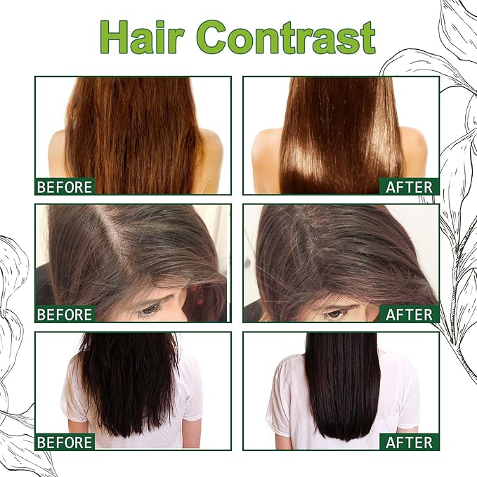 10ml Hair Growth Serum for Thinning Hair – Anti Hair Loss Treatment with Ginseng & Ginger Extract to Stimulate Follicles and Promote Denser, Stronger Hair
