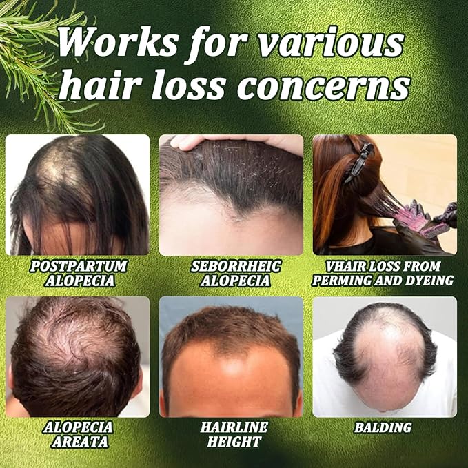 Rosemary Hair Growth Shampoo for Men and Women-Natural Thickening and Strengthening Formula with Biotin Hydrolyzed keratin -Designed for Thinning Hair & Hair Loss 10.15 fl.oz