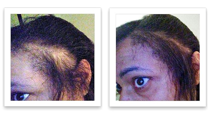 Caboki Hair Concealer (All-Natural Hair Building Fibers) Travel Size (Black)