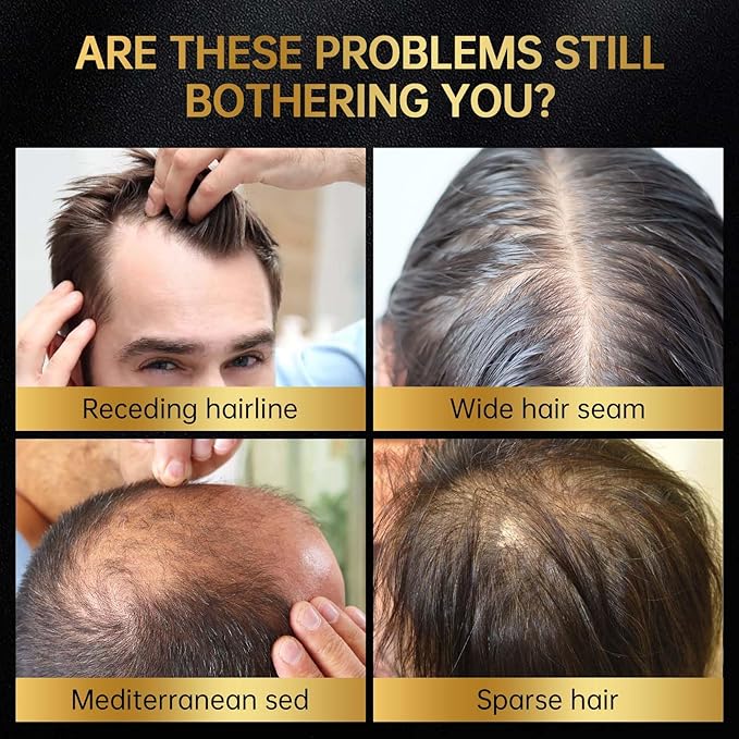 Minoxidil for Men & Women, With Biotin, Batana Oil, Rosemary Essential Oil, Effective Hair Loss Solution, Hair Loss Treatment for Hair Regrowth, Non-Greasy 5% Minoxidil - 60ml(Serum + Massager Set)