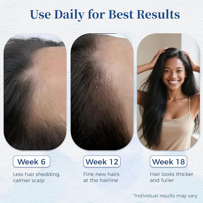 Hair Growth Serum Roll On with Rosemary，Helps Support Thicker, Fuller Hair Appearance，Clean, Non-Greasy Hair Loss Support for Men & Women，Saw Palmetto，0.84 Fl Oz (Pack of 2)