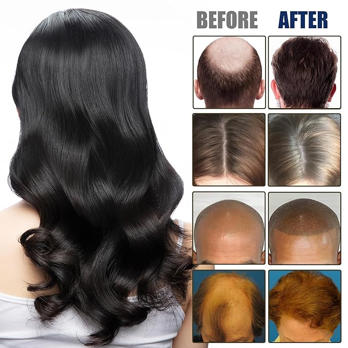 20g Hair Growth Cream for Thinning Hair – Stimulates Follicles, Reduces Hair Loss & Boosts Regrowth for Men and Women – Natural Scalp Treatment for Bald Spots & Receding Hairline
