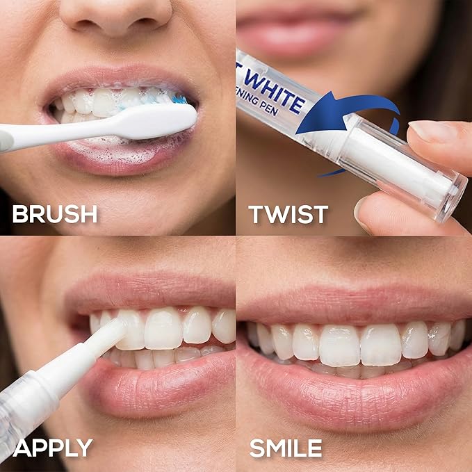 Venus Visage Award Winning Teeth Whitening Pen, 20+ Uses - Teeth whitening Kit Professionally formulated - Best Teeth whitening Gel Pen Teeth Whitener - Low Sensitivity (Mint) (0.07 Fl Oz (Pack of 2))