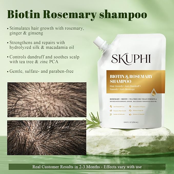 Rosemary Amino Acid Shampoo, Biotin Hair Growth Shampoo for Thinning Hair Women and Men Hair Loss Zinc PCA + Hydrolyzed Silk, Balancing & Nourishing Formula, 8.45 fl oz, 2-Pack