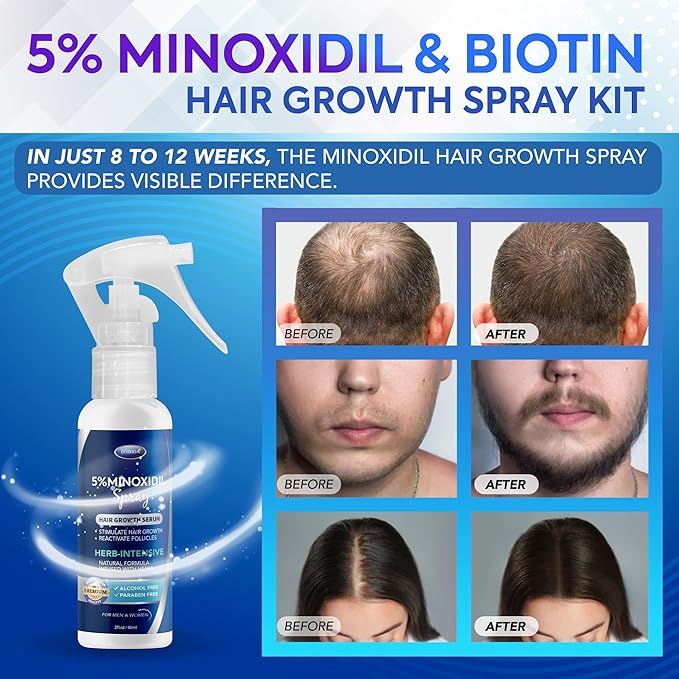 5% Minoxidil Hair Growth for Men and Women: Extra Strength Minoxidil and Biotin Beard Regrowth (2 Fl Oz, Spray 3pcs)