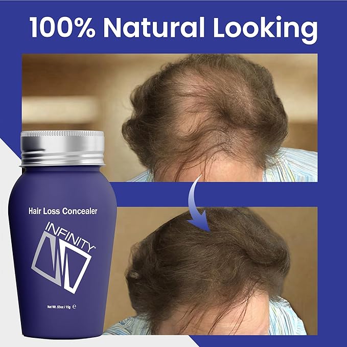 INFINITY Hair Fibers Dark Brown for Thinning Hair for Women & Men - 100% Undetectable Hair Building Fiber Powder - Conceal Hair Loss in 15 Seconds, 15g