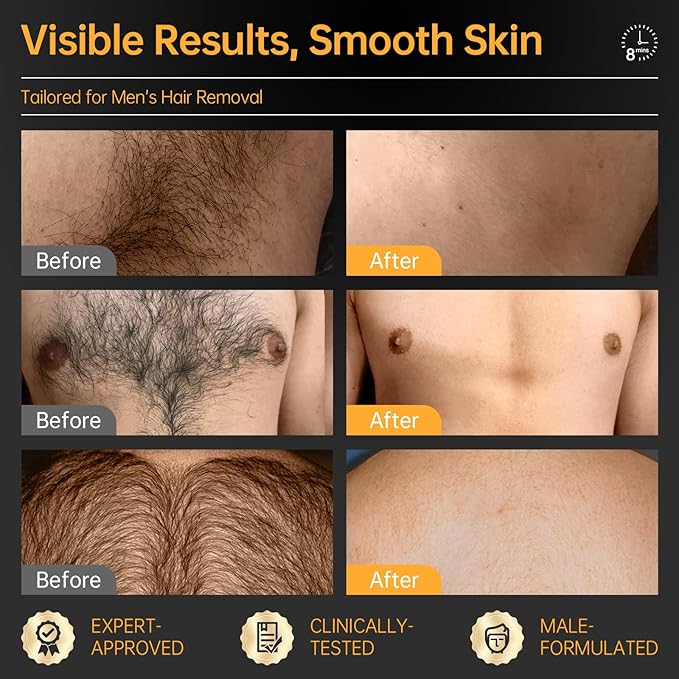 CKM Hair Removal Cream for Men, Depilatory Cream for Unwanted Male Hair, Painless Hair Removal Gel Suitable for All Skin Types, Made for Men, 3.38 FL OZ w/Spatula