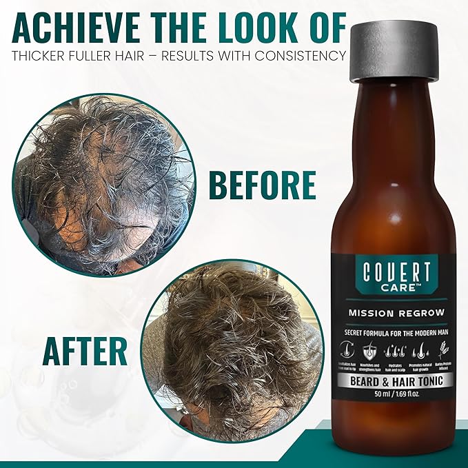 Hair and Beard Thickening Serum for Men – Lightweight Root Activator for Thinning Hair, Scalp Nourishment for Fuller, Stronger-Looking Hair