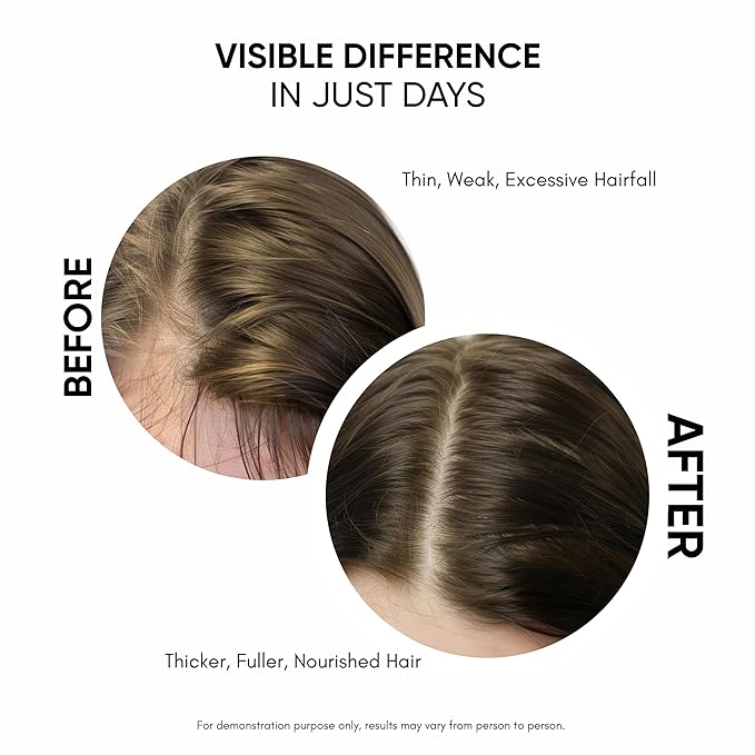 Hair Growth Serum For Density, Hair fall Control with 3% Redensyl, 5% Capixyl, 4% Anagain, 3% Procapil & 3% Baicapil, Rosemary & Biotin For Both Men & Women, 1.01 fl.oz./30ML
