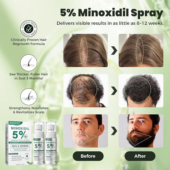 5% Minoxidil Hair Regrowth Spray for Men and Women with Rosemary Scent – 2 x 60ml Value Pack for 4+ Months – Lightweight Non Greasy Mist for Thinning Hair Receding Hairline Crown Support (Rosemary)